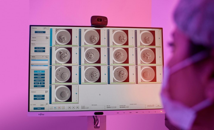 embryo-assesment-embryoscope.jpg